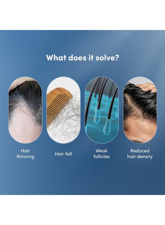 مان ماترز سيروم مان ماترز المتطور للشعر 30 مل | يحتوي على 23% من المكونات النشطة (3% ريدنسيل، 2% أناجين و1% أمينكسيل، بالإضافة إلى خلاصة أوراق إكليل الجبل) | يُنشط خلايا الشعر، ويُحسّن كثافته ويُعزز نموه | خالٍ من البارابين. - Image 4